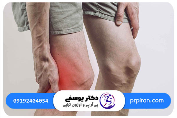 رفع درد زانو با پی آر پی