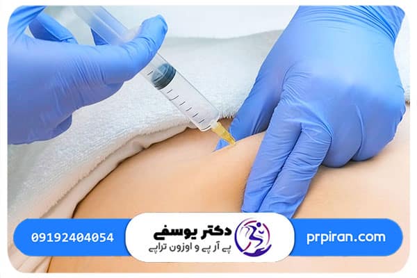 تاثیر اوزون تراپی بر درمان دیسک کمر