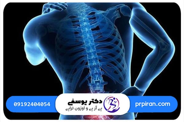 درد دیسک کمر خفیف به چه شکل است؟