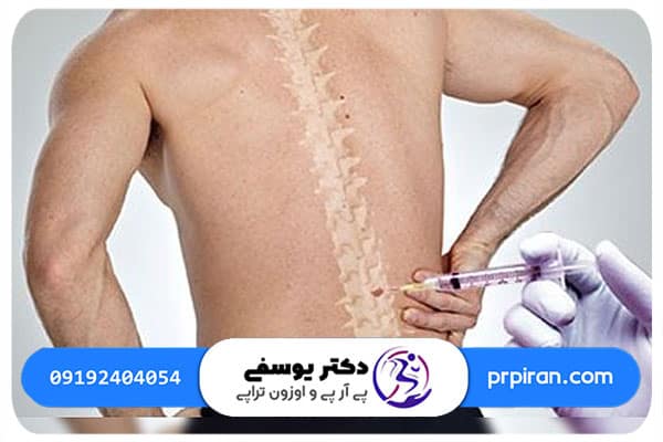مراحل اوزون درمانی دیسک کمر