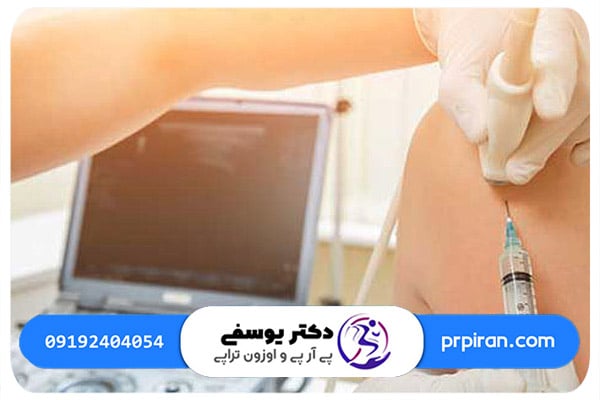 اوزون تراپی چیست و چگونه به درمان شانه یخ زده کمک می&zwnj;کند؟