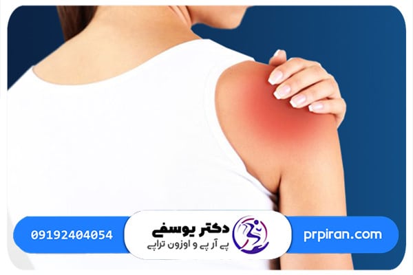 تاندونیت شانه چیست و به چه علتی به وجود می&zwnj;آید؟