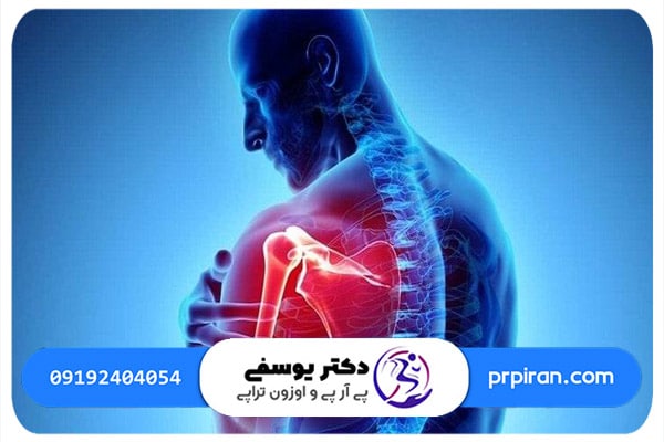 درمان آرتروز شانه با متد اوزون تراپی