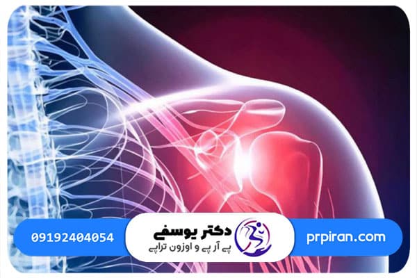 دلایل ساییدگی شانه چیست؟