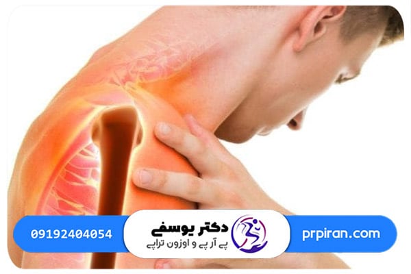 علائم آرتروز شانه
