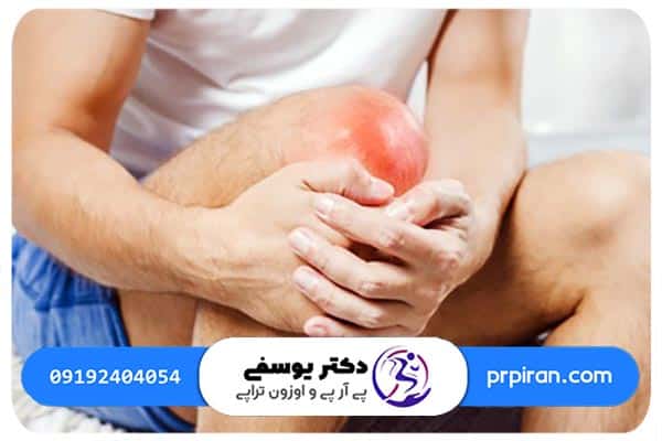 انواع آسیب رباط صلیبی زانو