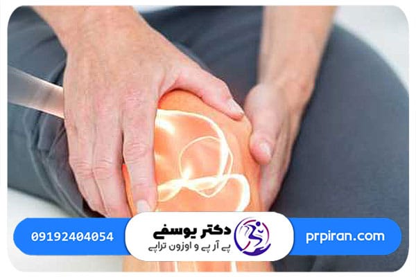 تعداد جلسات درمان رباط صلیبی زانو با روش پی آر پی