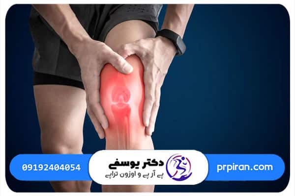 درمان زانو درد عصبی