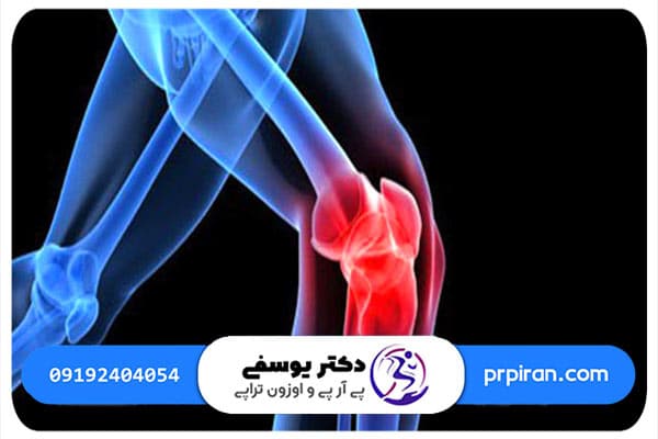 علائم مینیسک چیست؟