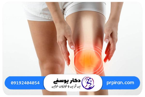 علت زانو درد عصبی