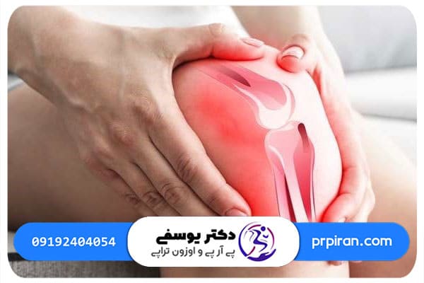 فرایند درمان پارگی رباط صلیبی زانو با پی آر پی