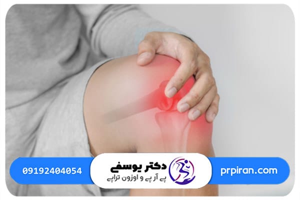 تأثیر تزریق پی آر پی در بازسازی غضروف&zwnj;های زانو