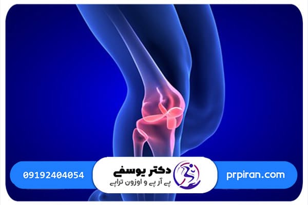 عوامل آسیب به غضروف زانو