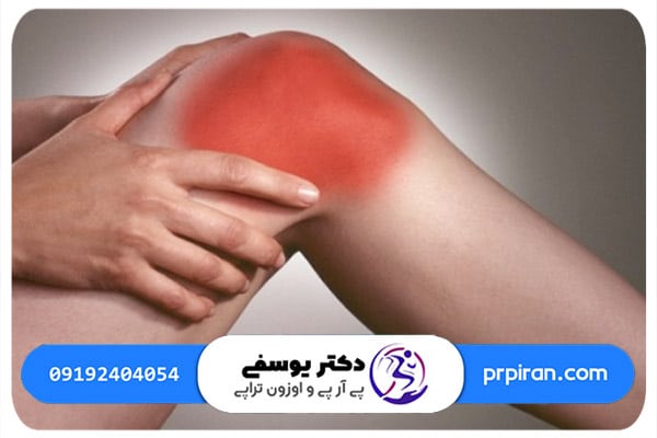 مراحل درمان ساییدگی کشکک زانو با پی آر پی