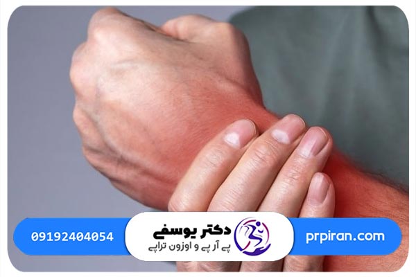 تأثیر پی آر پی در درمان در مچ دست