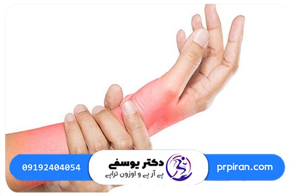 مزایای درمان درد مچ دست با تزریق پی آر پی
