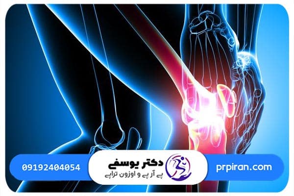 اوزون تراپی زانو چیست؟