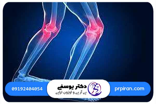 تاثیر عصب سیاتیک بر زانو درد چیست؟
