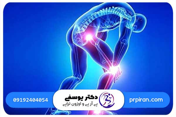 علل درد زانو ناشی از سیاتیک