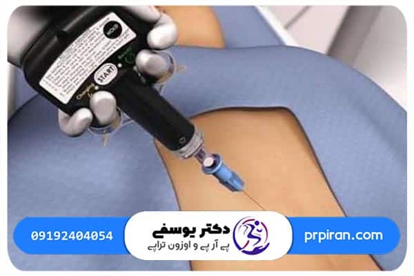 عوامل موثر بر قیمت آمپول اوزون