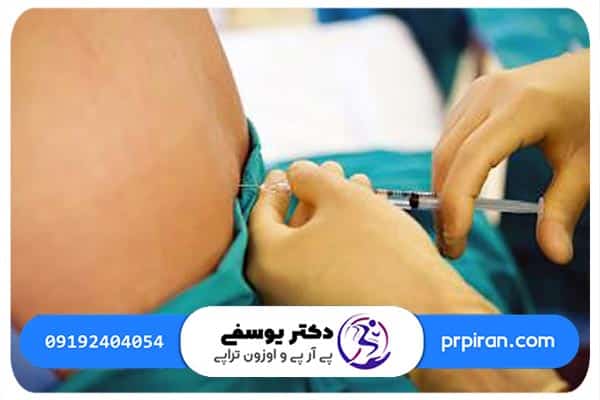 نحوه درمان سیاتیک با اوزون تراپی