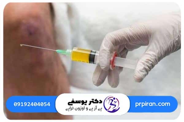  14 تا 49 روز بعد از تزریق پی آر پی