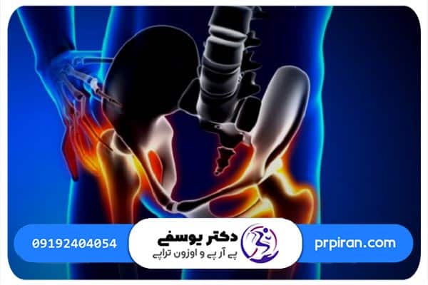 تشخیص علائم ساییدگی لگن