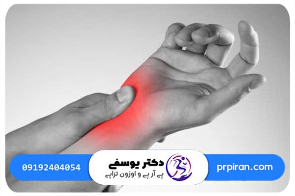 درمان سندروم تونل كارپال با تزريق پي آر پي