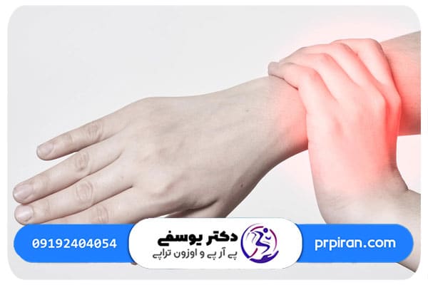 دلايل ايجاد تاندونيت مچ دست