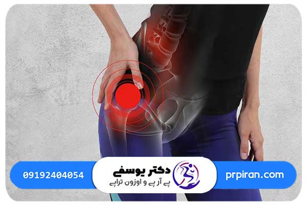 علائم آرتروز لگن چيست؟