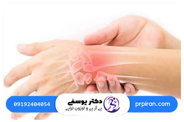 علائم تاندونيت چيست؟