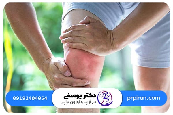 مصرف غذاهای کلاژن&zwnj;دار برای تقویت درد مفاصل زانو