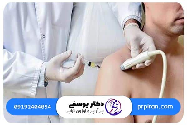 پی آر پی شانه برای درمان چه عارضه هایی مفید است؟