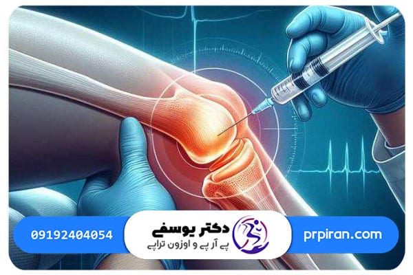 درمان زانو درد در بارداري با پي آر پي زانو چگونه است؟