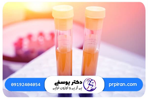 عوارض پي&zwnj; آر&zwnj; پي زانو براي خانم&zwnj;هاي باردار