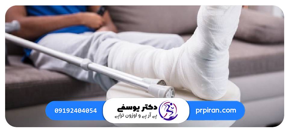 شکستگی پا | دكتر ناصح يوسفی